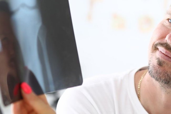 Osteoporoza si boala celiaca